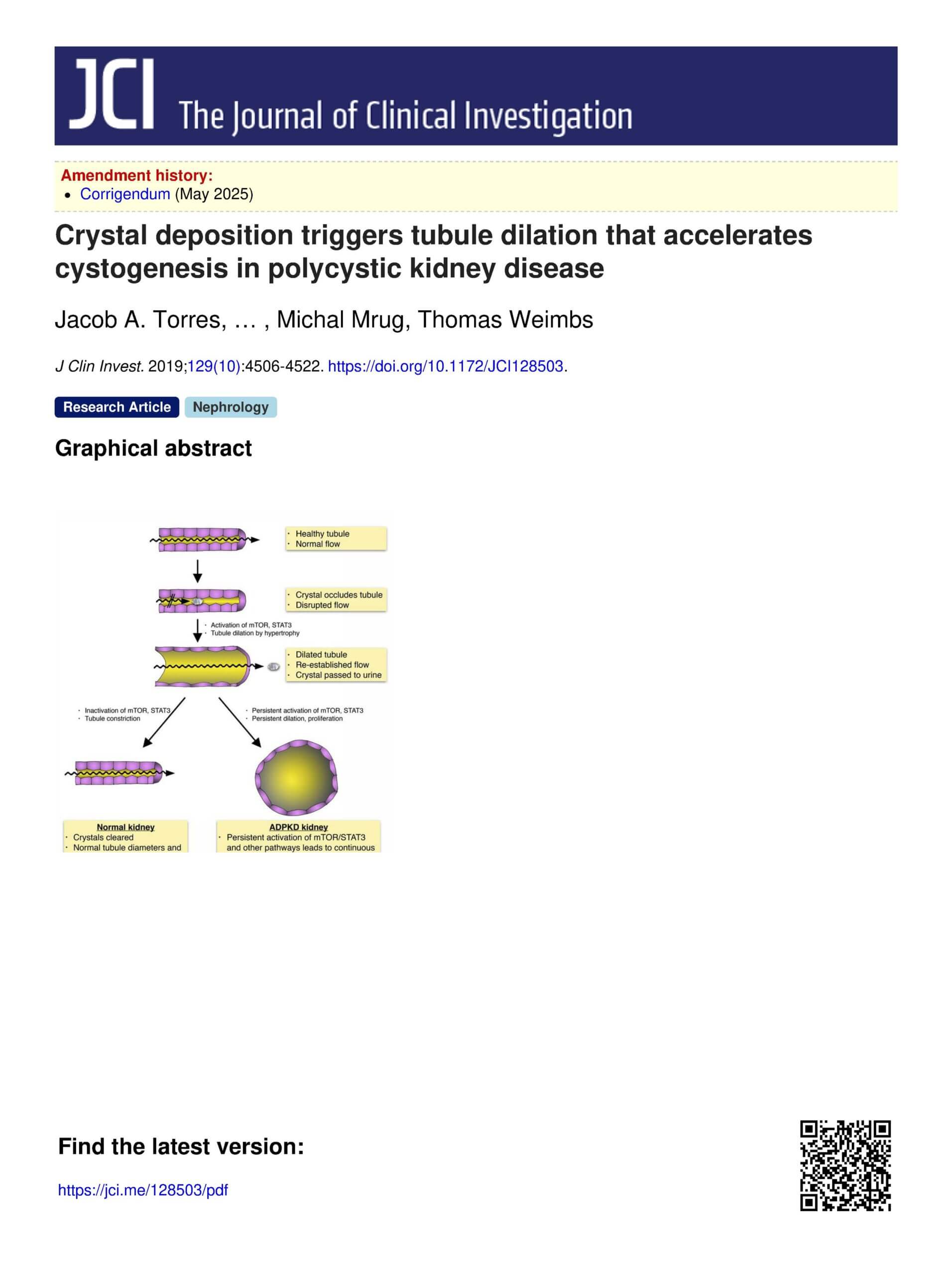 4 Crystal Deposition Triggers Bule Dilation That Accelerates 1