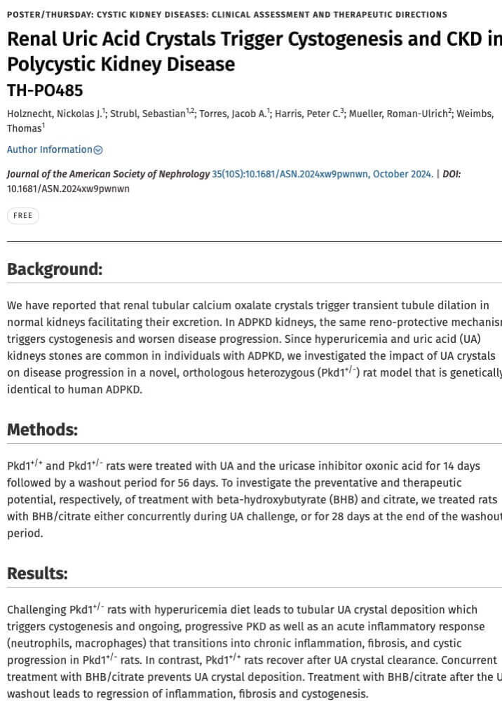 Renal Uric Acid Crystals Trigger Cystogenesis and CKD in Polycystic Kidney Disease